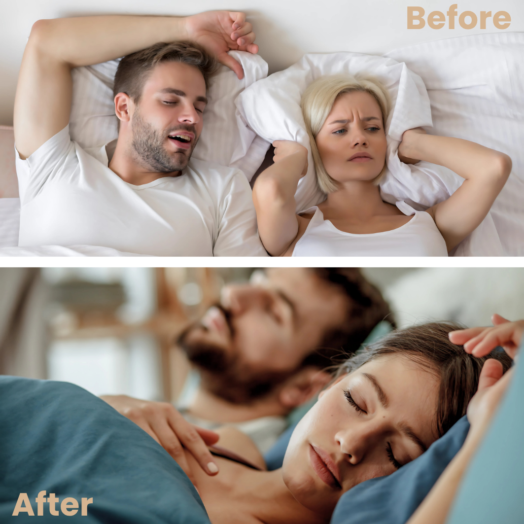 NoSnore Flex™ Anti Snoring - Snoring Mouth Piece - Adjustable Custom Impression Snore Device