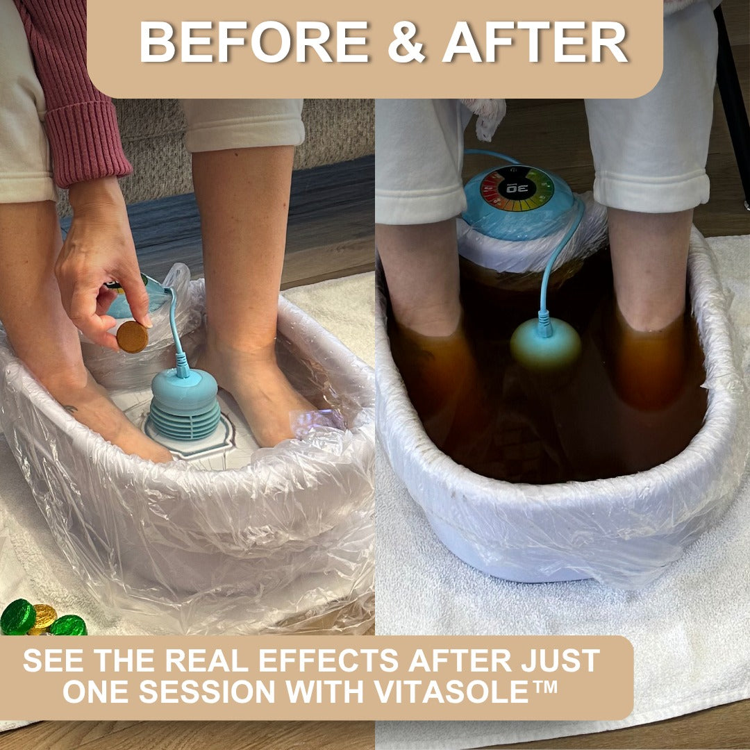 VitaSole™ Ionic Foot Spa (Upgraded) Home Detox & Energy Boost