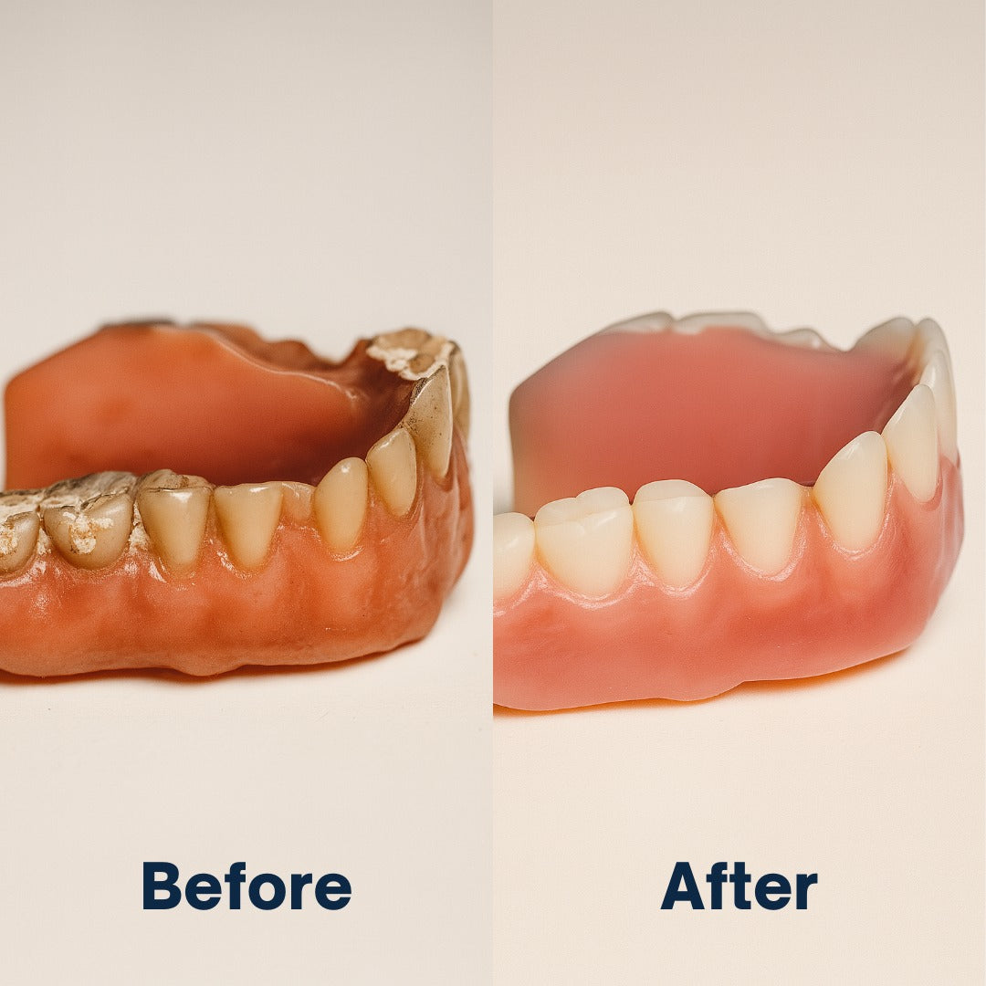 GlowGuard™ - Ultrasonic Cleaning Machine for Dentures, Retainers, Invisilgn e Dental devices